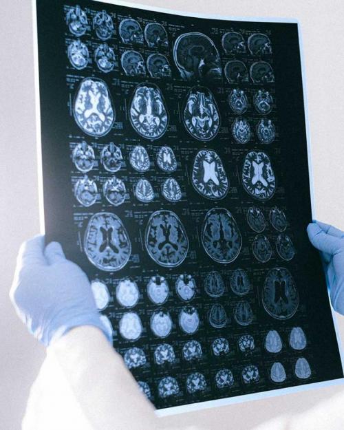		Person holds up images of a brain on film 
	