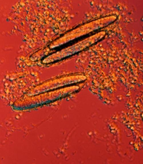 		 Microbe
	