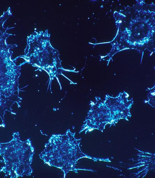  cancer cells