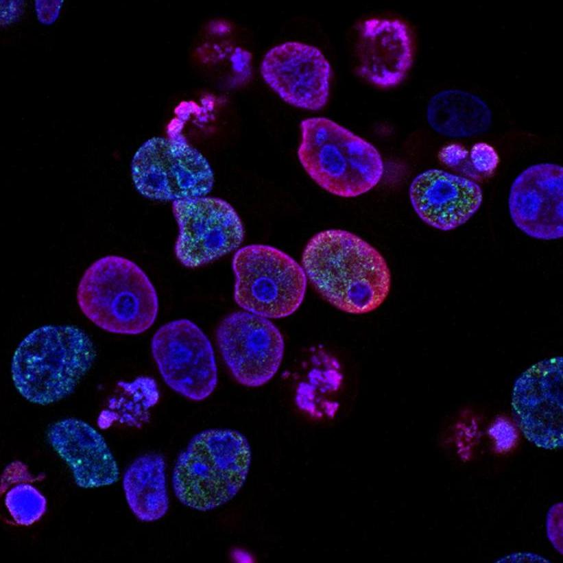Cells, magnified and dyed purple