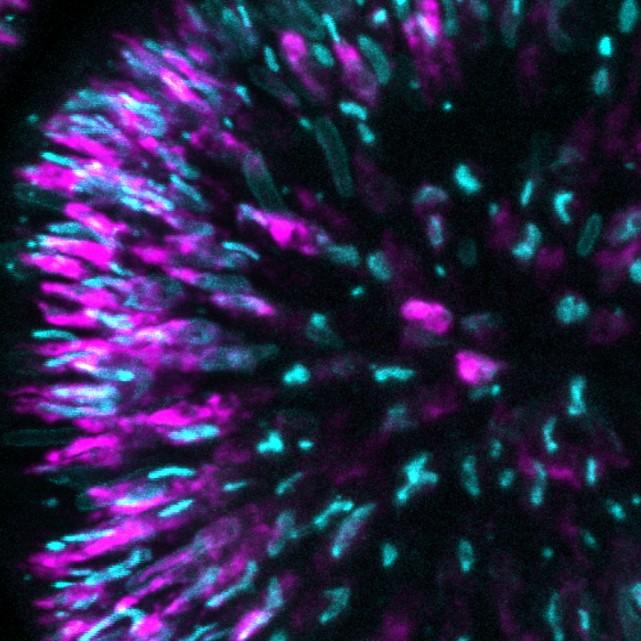Purple and green spikes radiate outward in a microscopic image of a cell