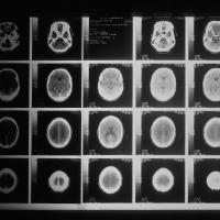		Grid of 20 black and white images of an oblong shape: a brain seen from above
	