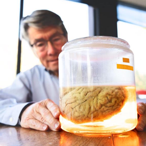 Clear jar with a brain inside, with a person behind it