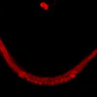 		An x-ray image of a worm, curved up like a smile, all red.
	