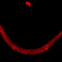 An x-ray image of a worm, curved up like a smile, all red.