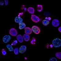 Cells, magnified and dyed purple