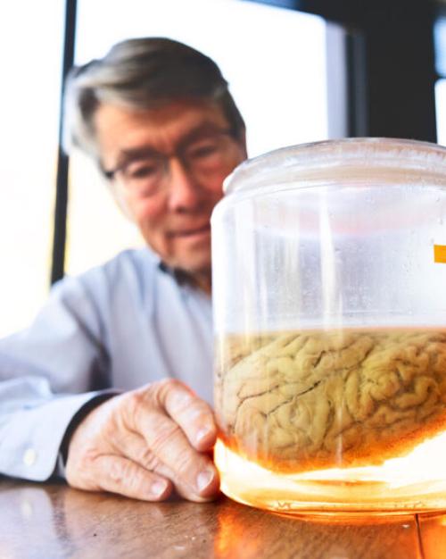 		Clear jar with a brain inside, with a person behind it
	