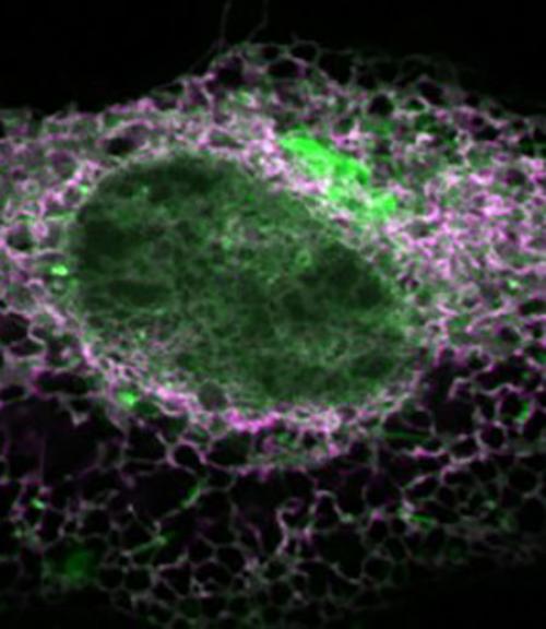 Fluorescence micrograph of a live HeLa cell.