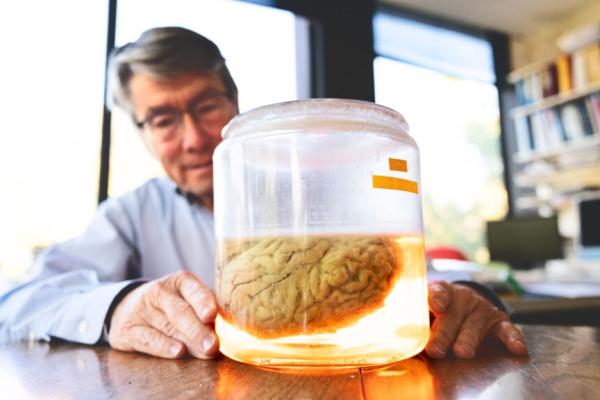 Clear jar with a brain inside, with a person behind it
