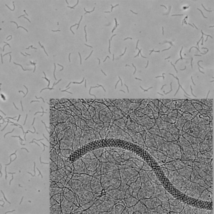 Black and white magnified image; various fields of gray covered with squiggles