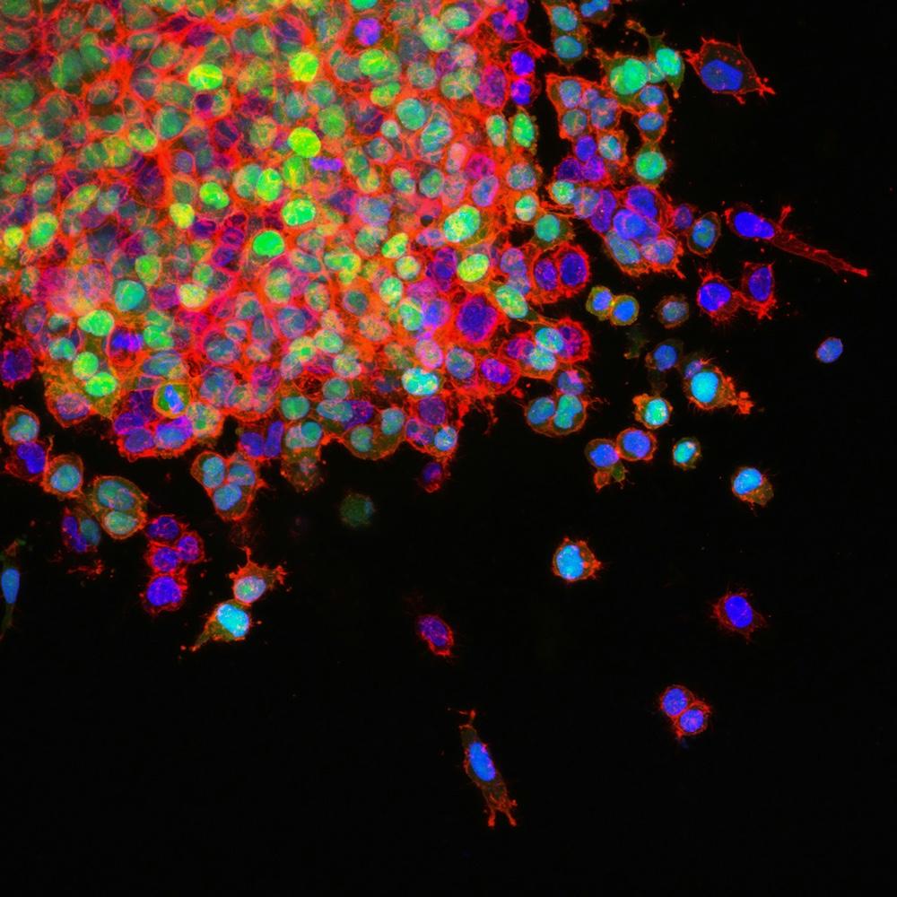 cells, appearing as brightly colored dots against a black background
