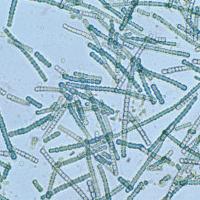 blue-green sticks made of segments (cyanobacteria) agaisnt a blue background