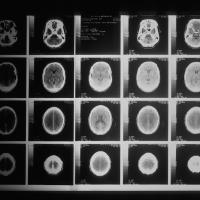 Grid of 20 black and white images of an oblong shape: a brain seen from above