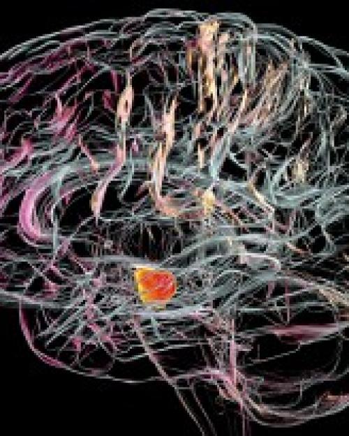 		Outline of a brain in colorful lines against a black background
	