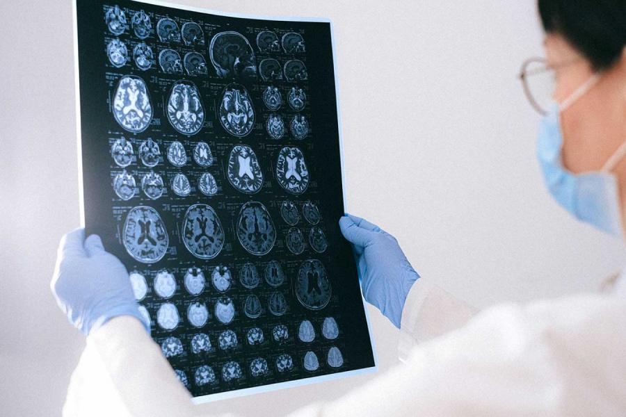 Person holds up images of a brain on film 