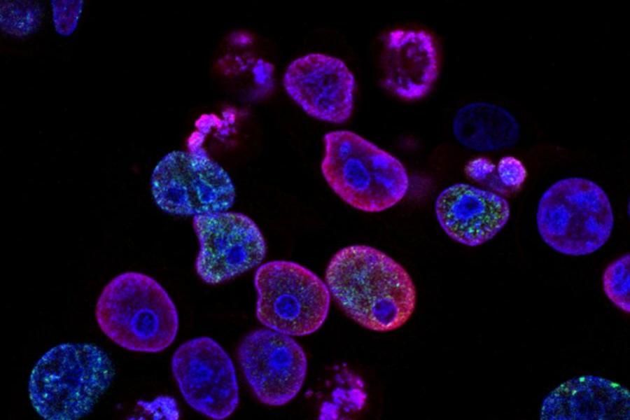 Cells, magnified and dyed purple