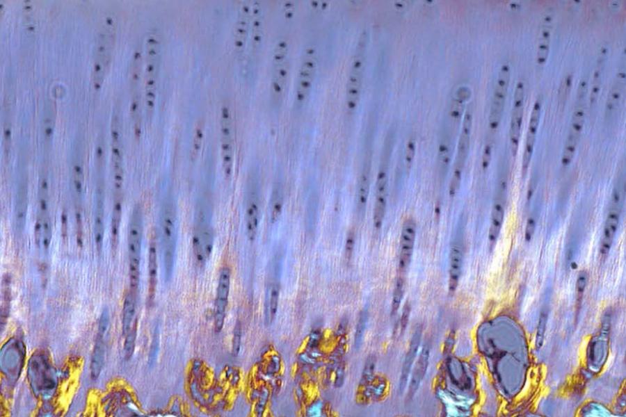 microscopic view showing purple field with black spots