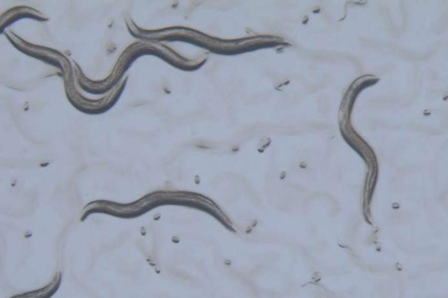 dark gray worms with pointed ends surrounded by dots of other microscopic things