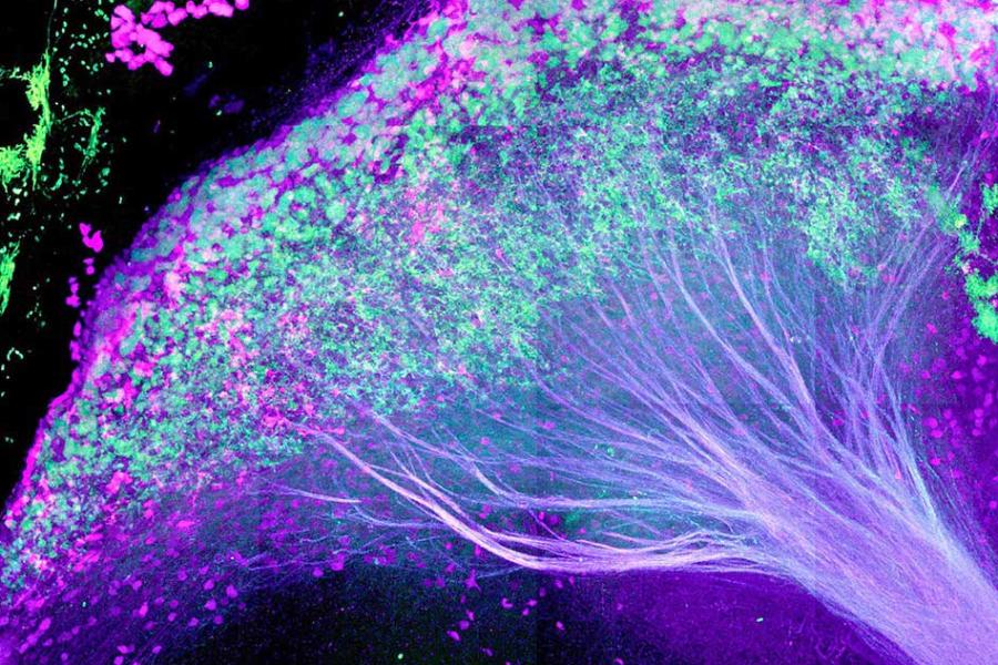 Luminescent tree-like structure with purple branches and bright green canopy: The lateral habenula in the mouse brain