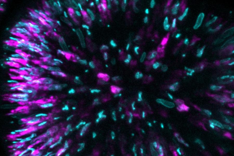 Purple and green spikes radiate outward in a microscopic image of a cell