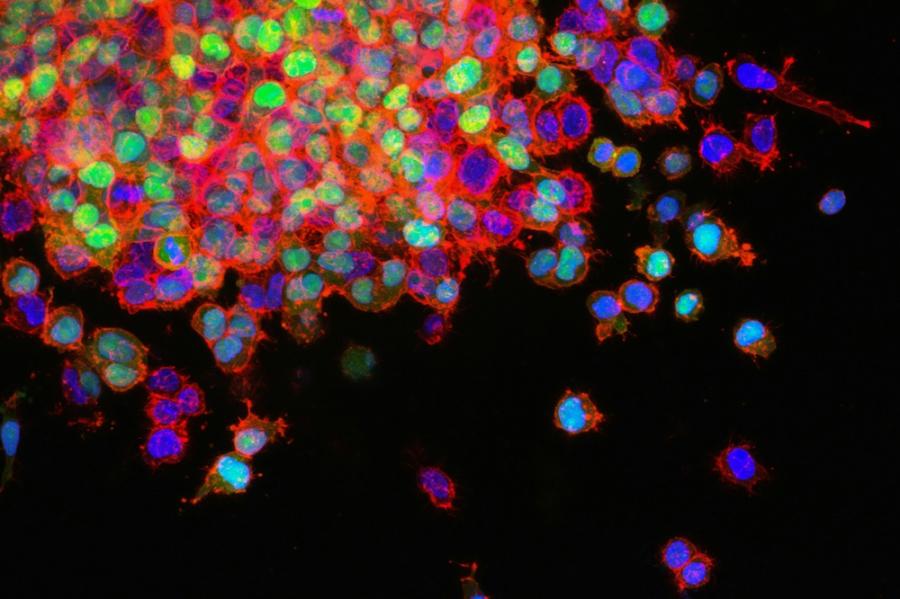 cells, appearing as brightly colored dots against a black background