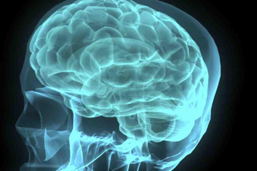  Brain and skull rendering